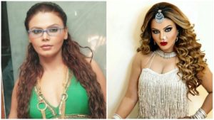 Rakhi Sawant On Breast Surgery : 16 की उम्र में करवाई ब्रैस्ट सर्जरी को राखी ने बताया जीवन का खौफनाक अनुभव