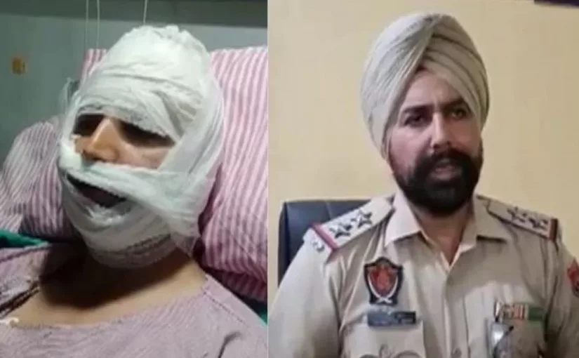 पुलिस वालों ने गाली देने से मना किया तो बदमाश युवकों ने कर दिया हमला, 2 की हालत नाजुक