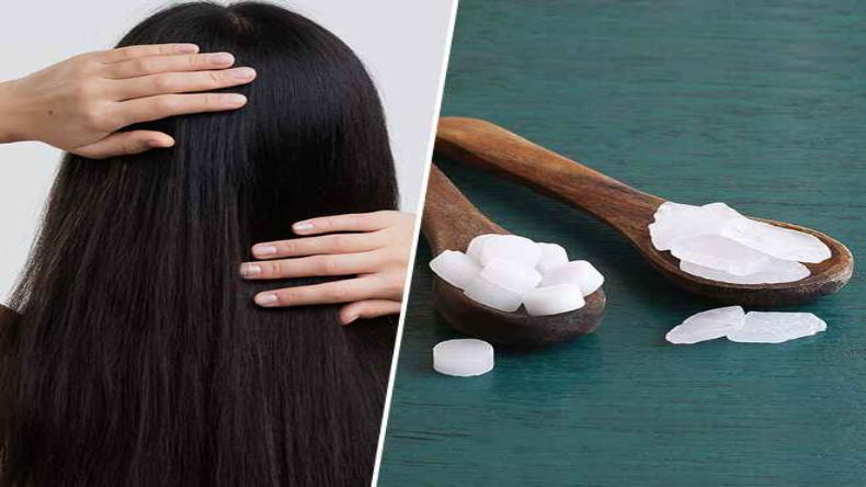 Dandruff Remedy: डैंड्रफ की परेशानी से निजात पाने के लिए करें कपूर से बने इस तेल का इस्तेमाल