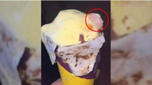 ice cream in cut finger