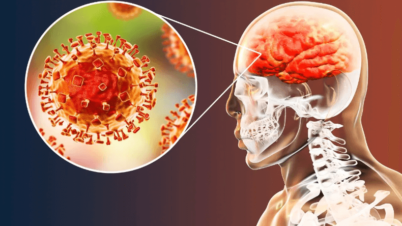 Brain Infection: मानसून में दिमाग पर अटैक करने वाले इंफेक्शन, जानें लक्षण और बचाव के तरीके