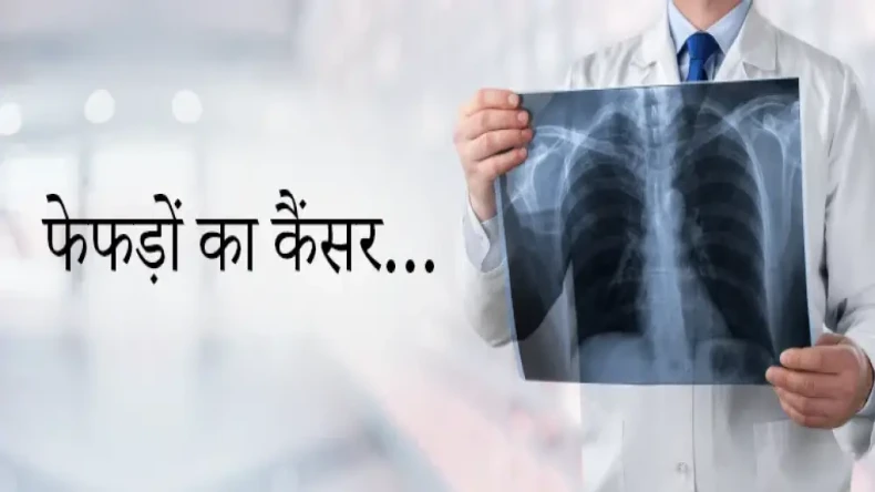 World Lung Cancer Day: क्या महामारी कोविड के बाद बढ़ गए लंग कैंसर के मामले?